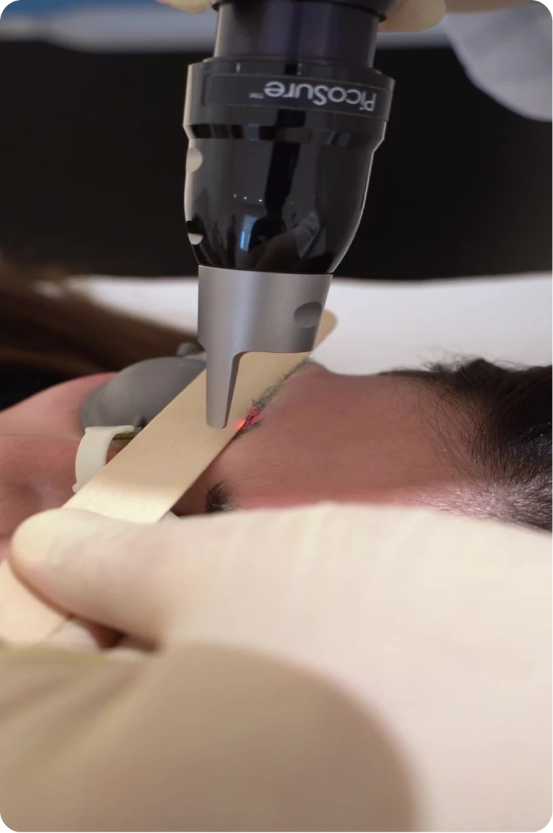 Yaqoot skin treatment