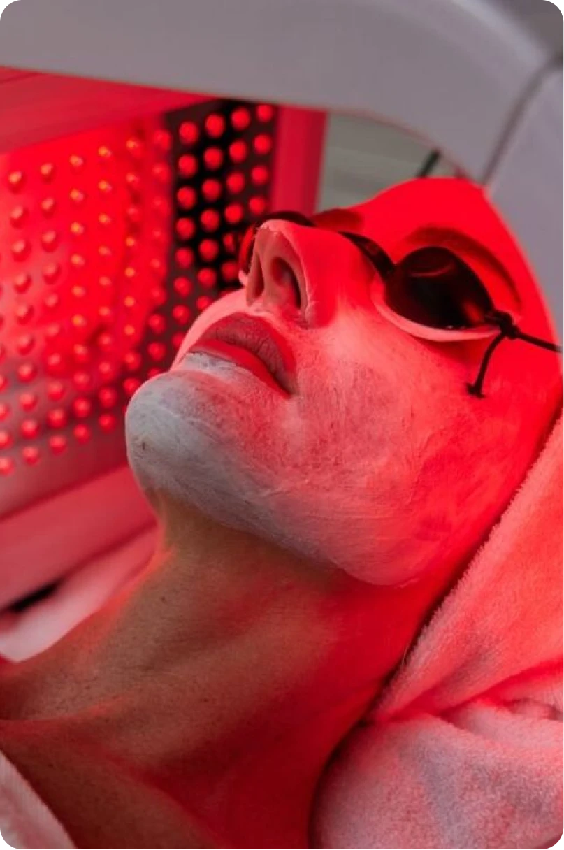 Yaqoot skin treatment