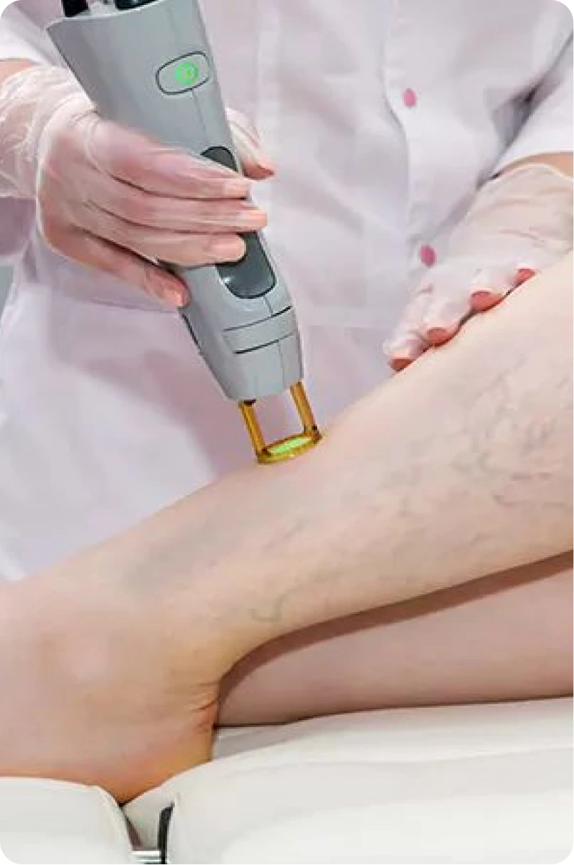 Yaqoot skin treatment