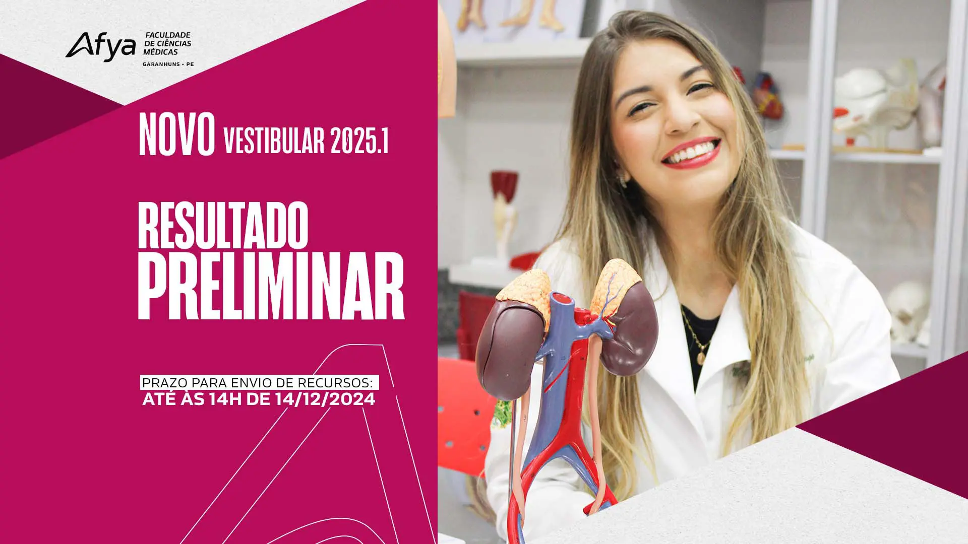 2º Vestibular On-line 2025.1: Resultado Preliminar já está disponível