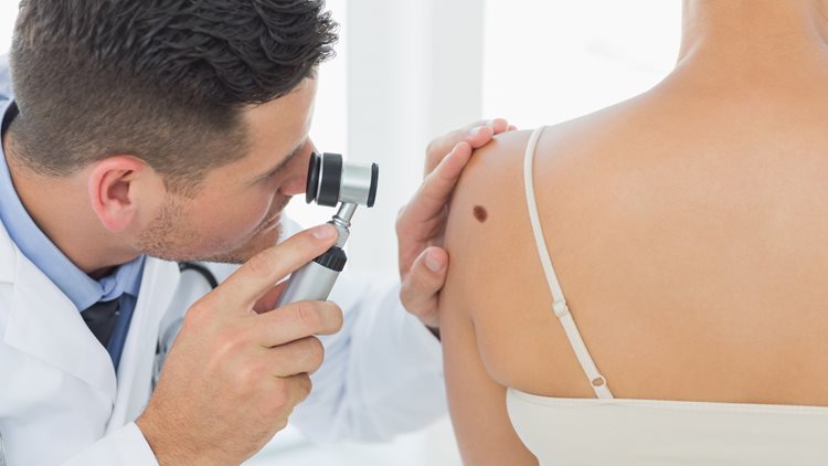 Junho Preto: Mês de conscientização sobre o melanoma