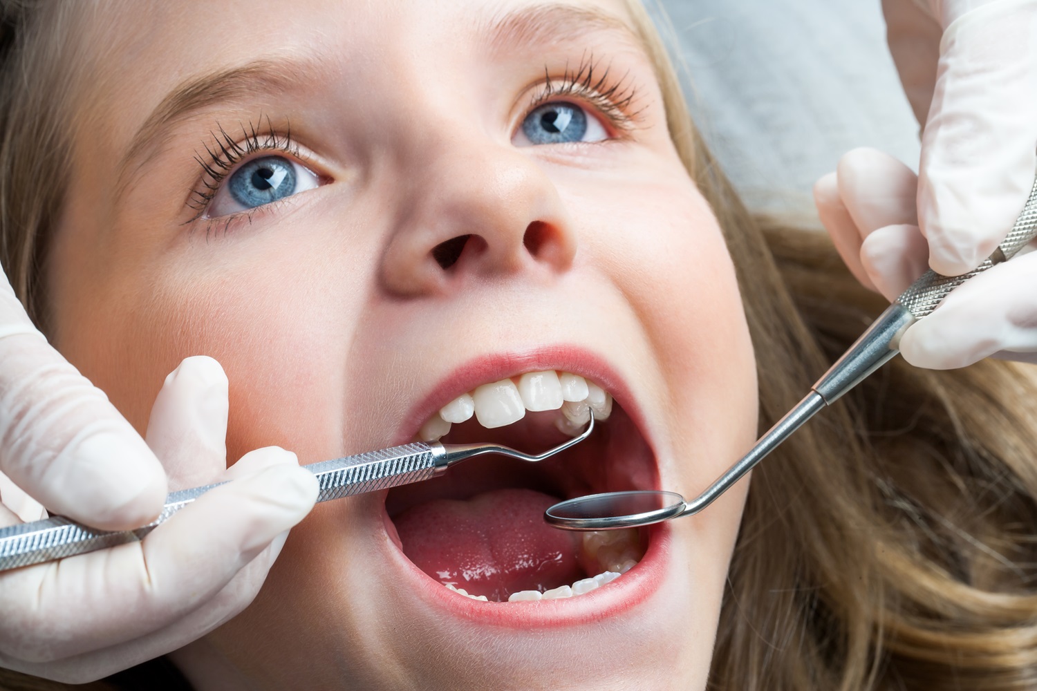 Curodont Treatment Shelbyville TN
