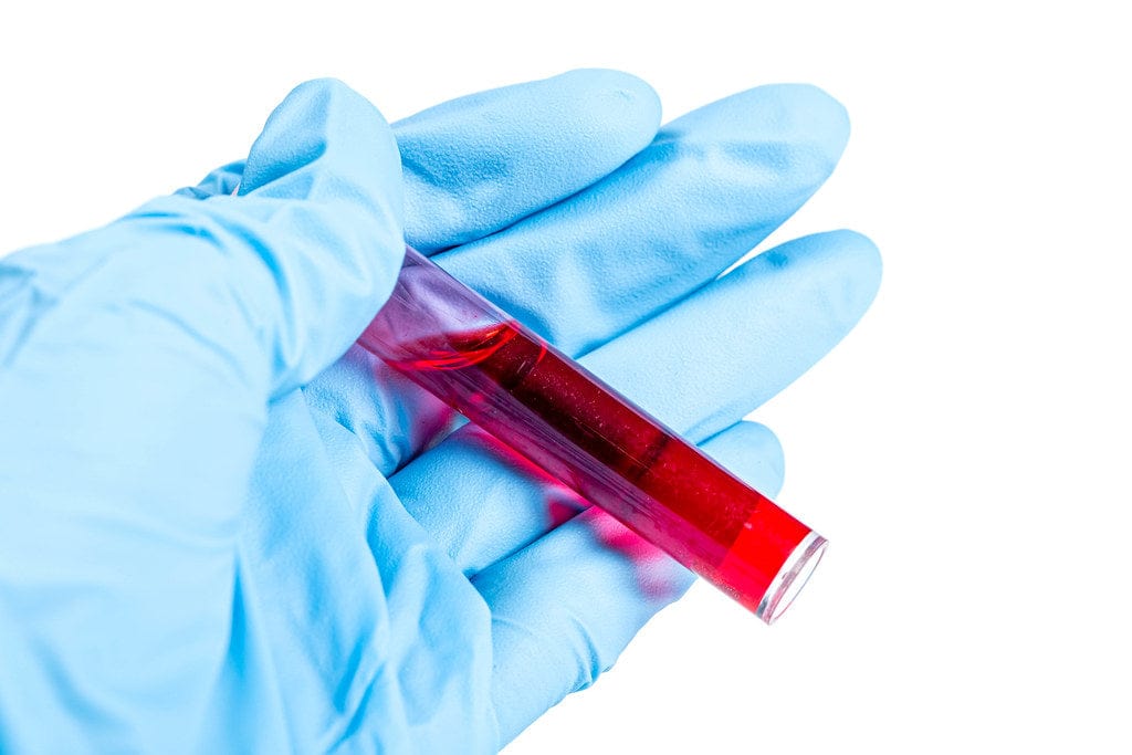 Blood test tube