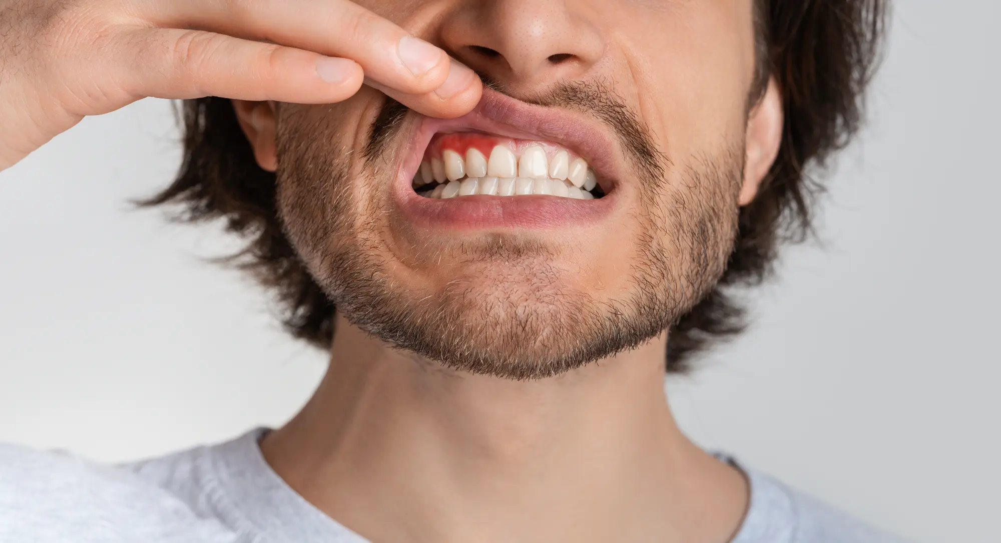 Preventive Care: Protecting Your Smile Before Problems