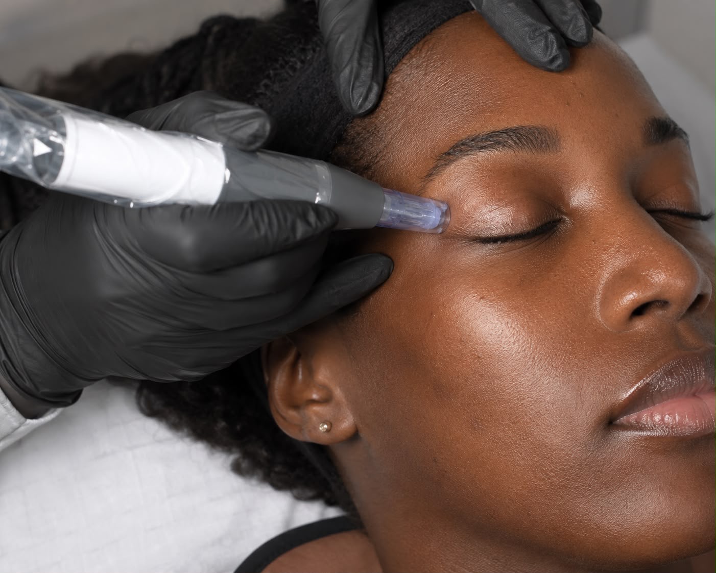 Advanced Microneedling + Skin Prep