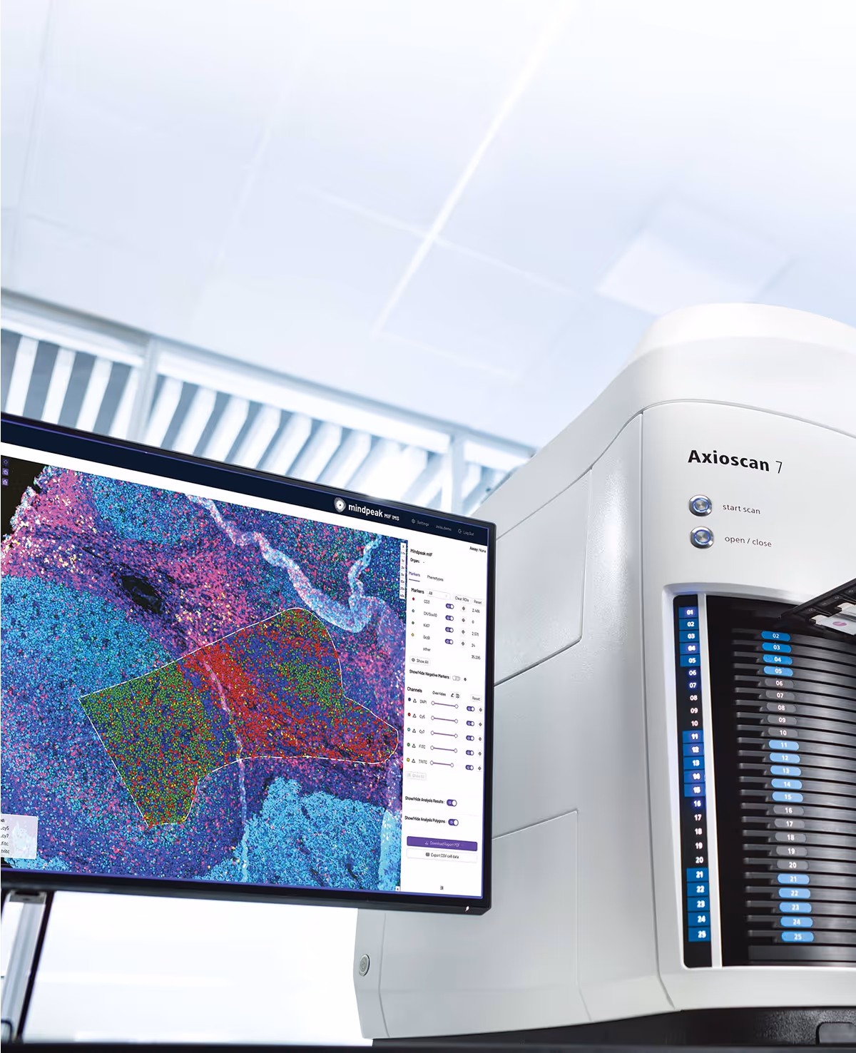 Axioscan 7 digital slide scanner displaying mindpeaks mif microscopic tissue image on a connected monitor.