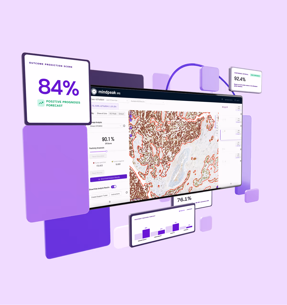 Mindpeak IMS medical software displaying tumor analysis with 84% positive prognosis forecast and 92.4% confidence interval on a purple background.