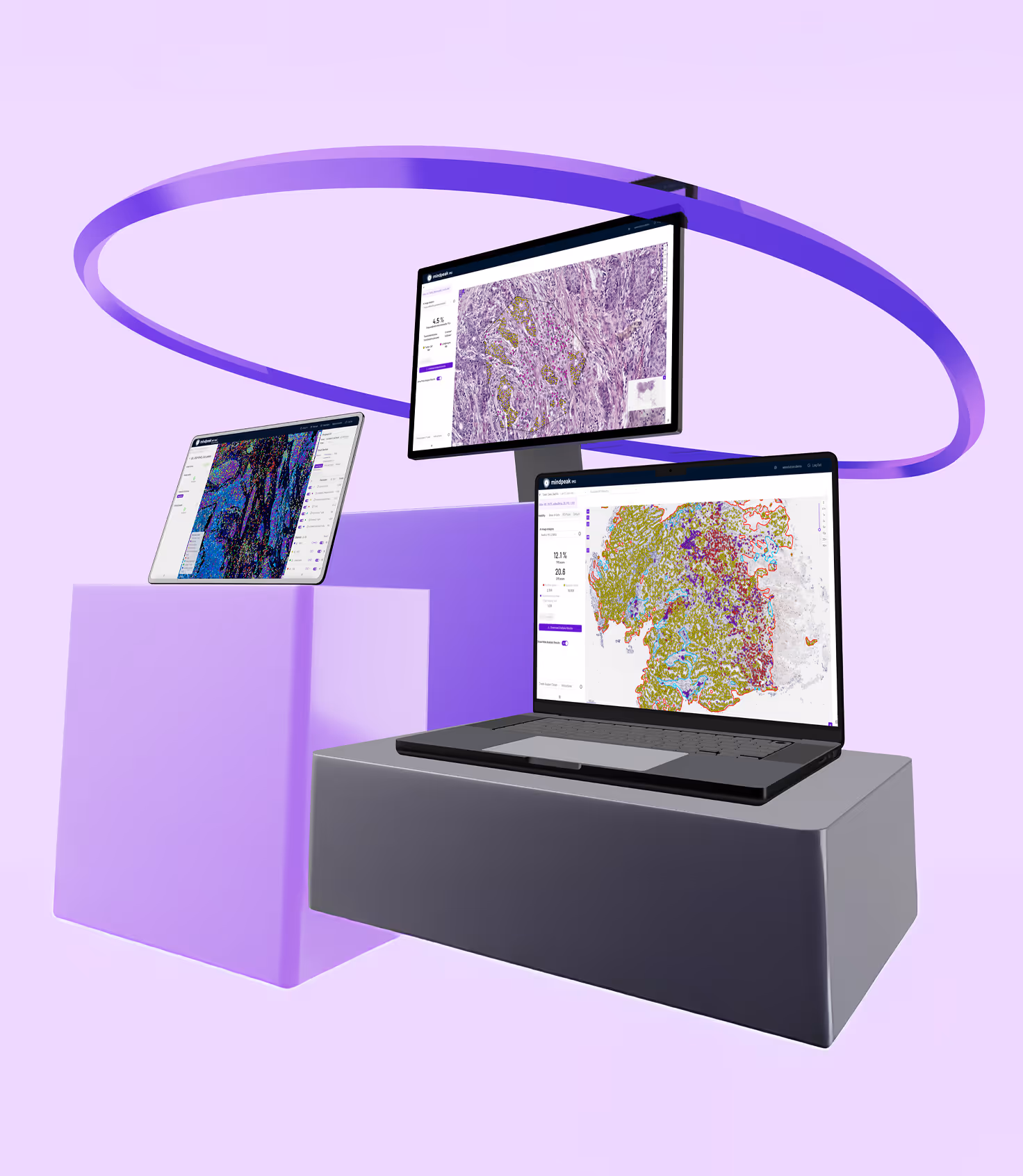 Three screens displaying digital pathology images with colored annotations on a purple background with abstract platforms and a circular purple ring.