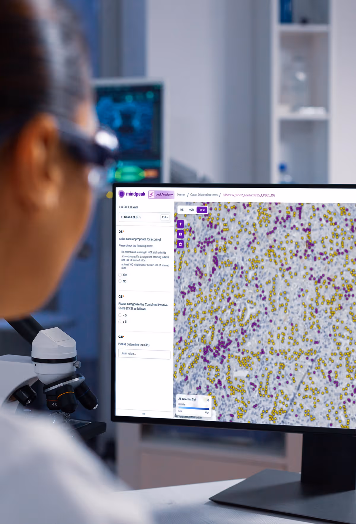 Person wearing glasses analyzing a digital pathology slide with AI-marked cells on a computer monitor beside a microscope in a lab.