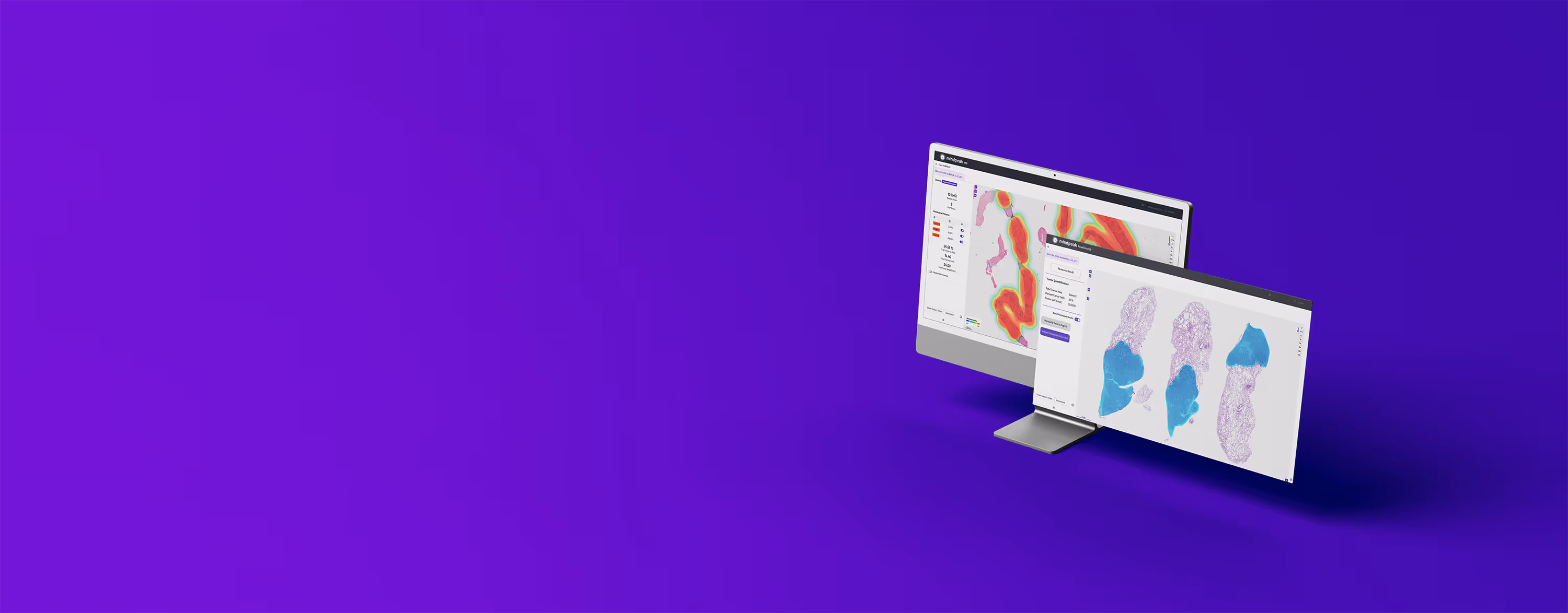 Two angled computer monitors display scientific data with colorful heatmaps and tissue images on a purple background.