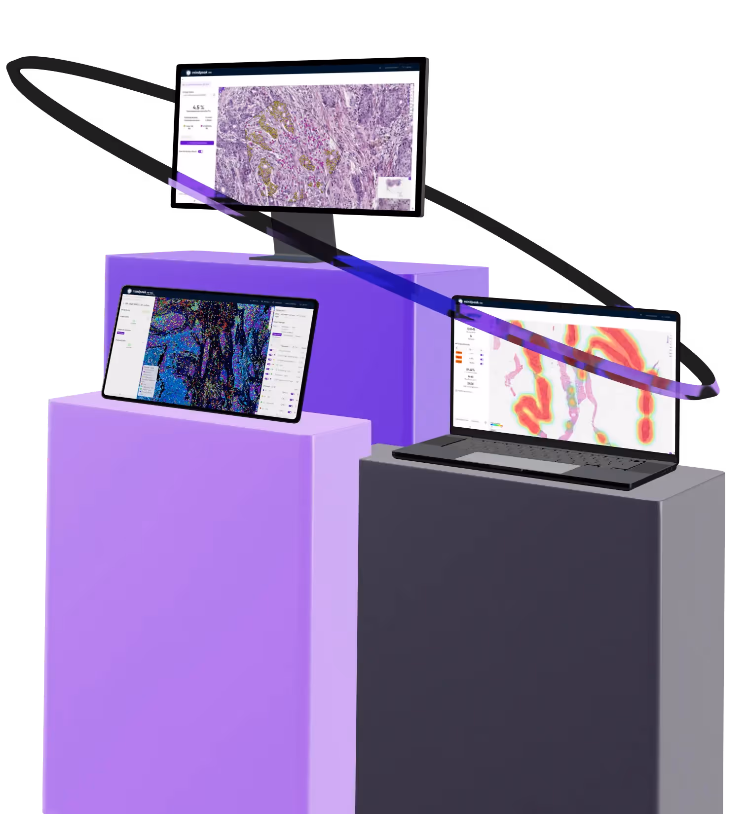Three electronic devices on purple and gray pedestals displaying colorful scientific or medical image analysis software interfaces.