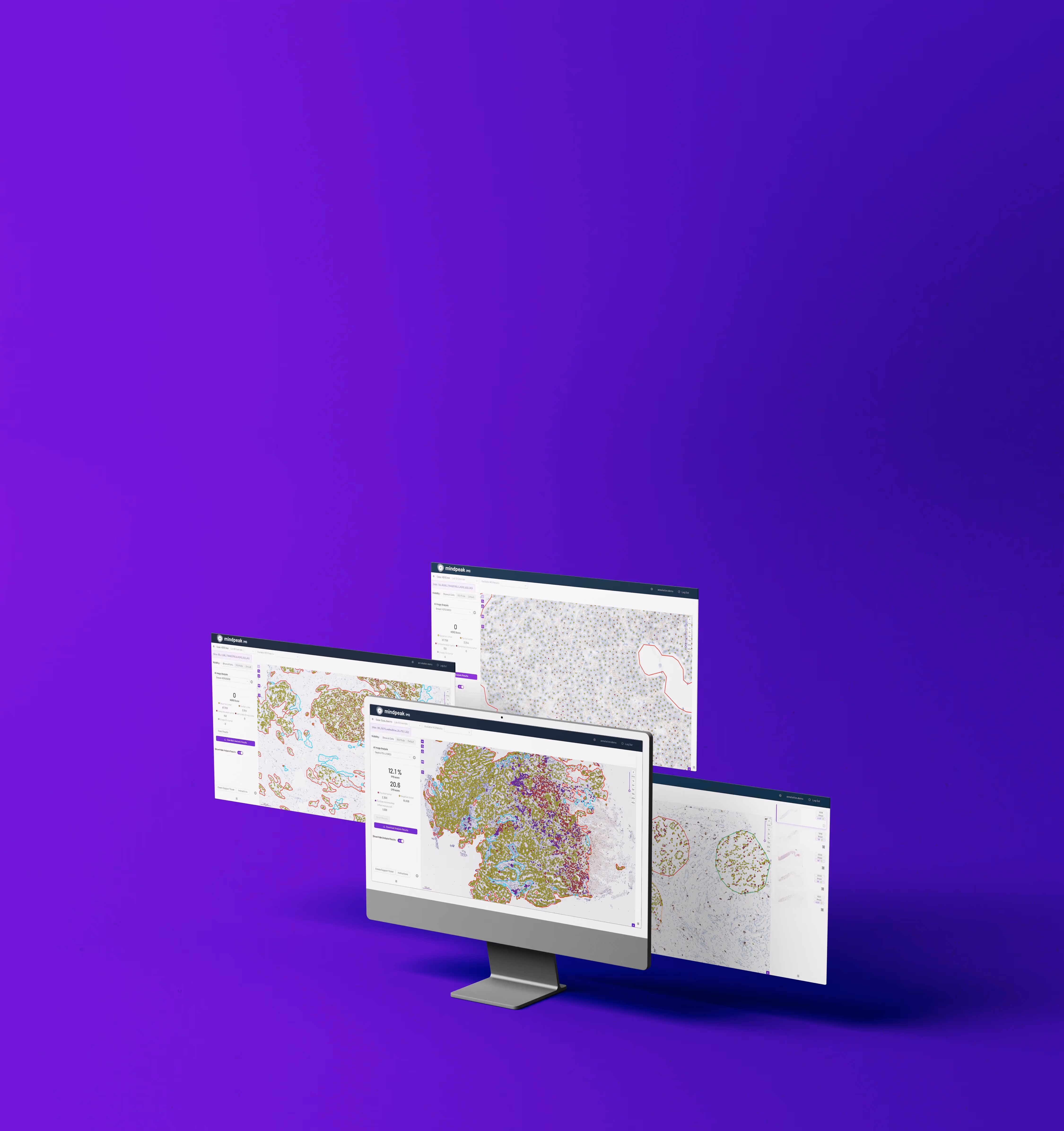 Computer monitor displaying detailed tissue imaging software with three expanded views of annotated histopathology slides on a purple background.
