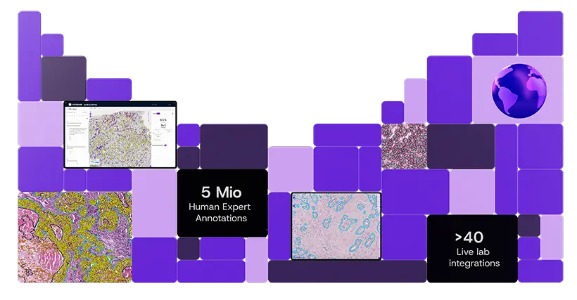 Computer monitor displaying digital pathology slide with highlighted tissue areas, alongside floating panels sitting on a purple desk.