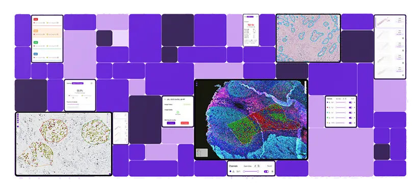 Computer monitor displaying digital pathology slide with highlighted tissue areas, alongside floating panels sitting on a purple desk.