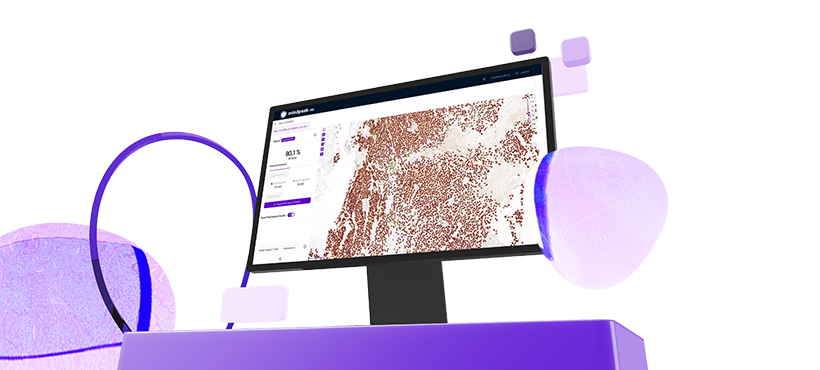 Computer monitor displaying digital pathology slide with highlighted tissue areas, alongside floating panels sitting on a purple desk.