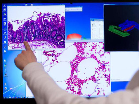 Das Hamburger Unternehmen "Mindpeak" entwickelt eine innovative Technik zur Diagnose von Krebs. Künstliche Intelligenz soll das Erkennen von Tumorzellen beschleunigen und sicherer machen - und den Ärzten mehr Zeit für die Patienten ermöglichen.