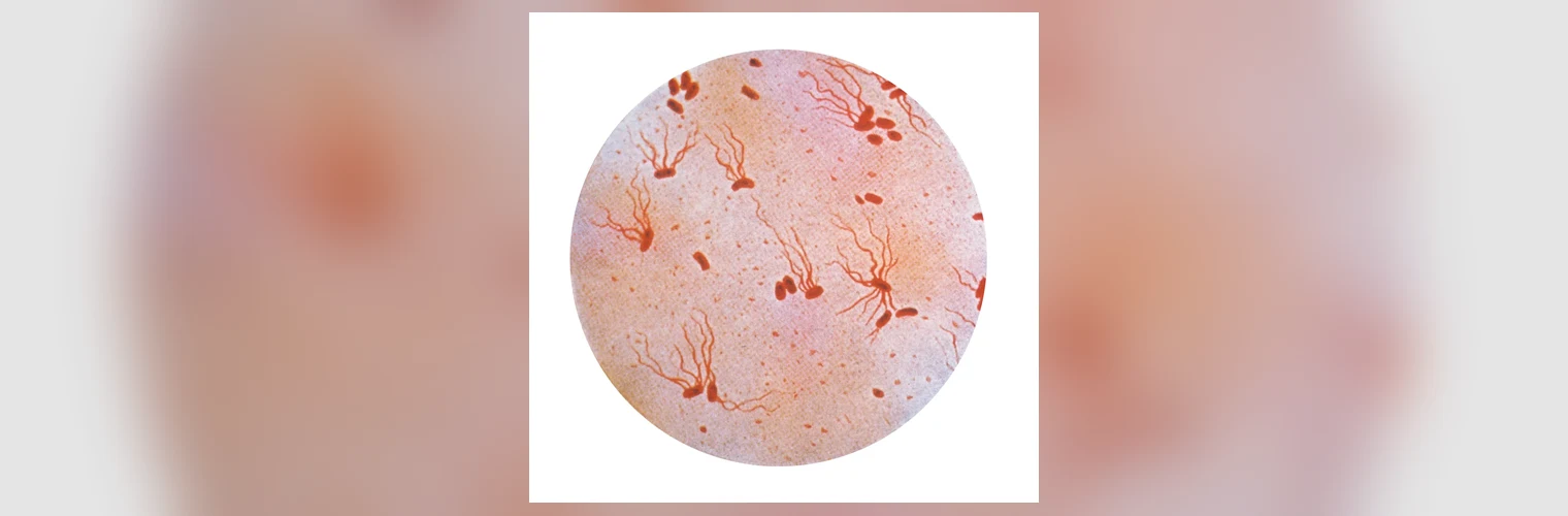 Mikrografia bakterii Salmonella Typhi wybarwionych metodą Grama, pałeczki Gram-ujemne (czerwono-różowe) widoczne w powiększeniu mikroskopowym; patogen wywołujący dur brzuszny.