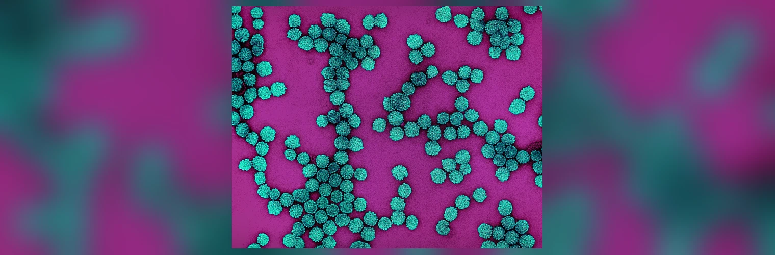 Kolorowana mikrografia elektronowa przedstawiająca liczne kuliste cząstki wirusa brodawczaka ludzkiego (HPV) w odcieniu turkusowym, wyizolowane z hodowli komórkowej.