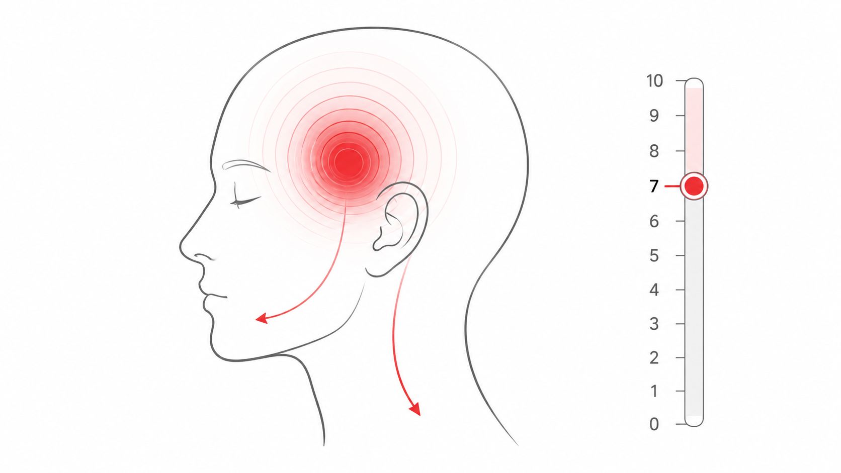 A diagram representing a migraine symptom with a pain scale set to level seven on the right side.