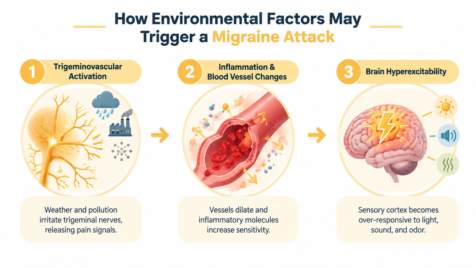 A diagram illustrating how environmental triggers like pollution and weather lead to migraines through three biological steps.