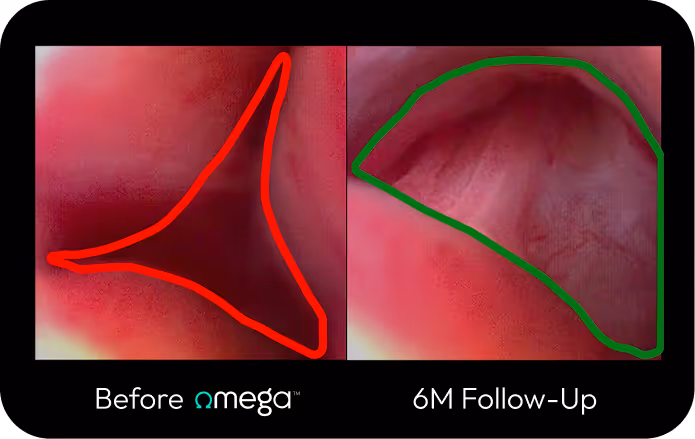Clinical Progress
