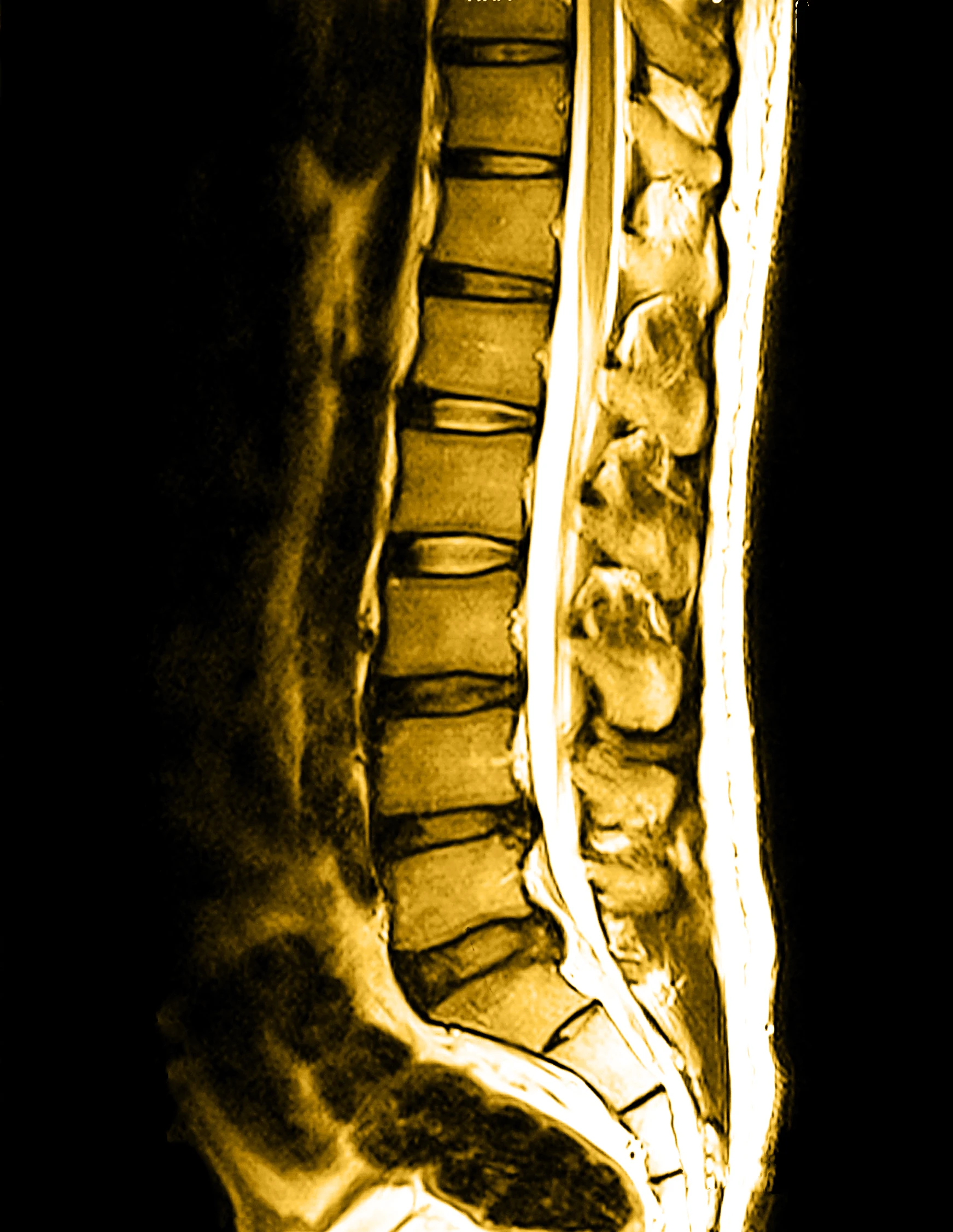 uMR 680 MRI machine in an imaging suite