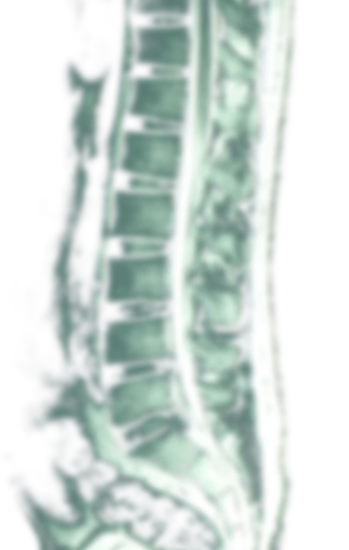 PLACEHOLDER ghost 1 - swap for a spine MRI