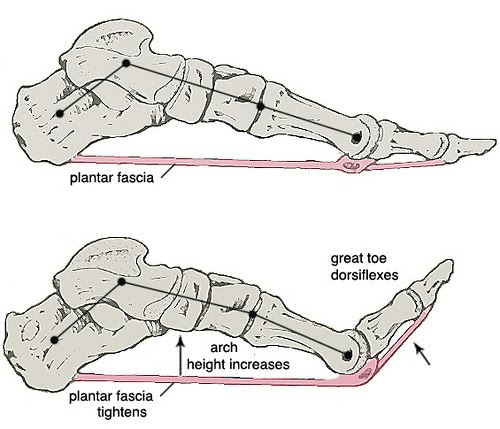 Plantar Plate Tears & Injury