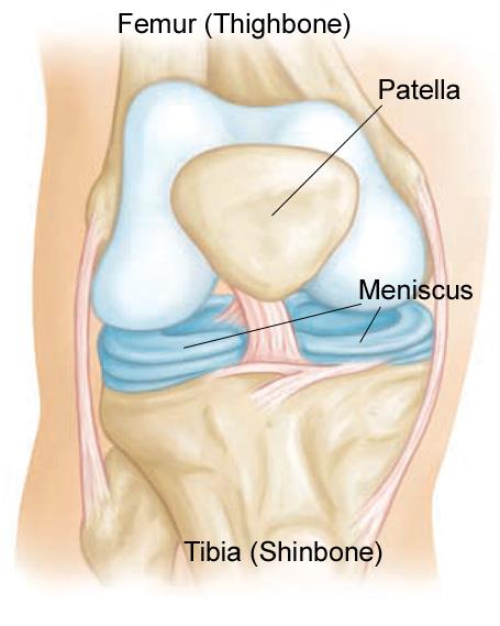 Meniscus Tears - Classification & Management