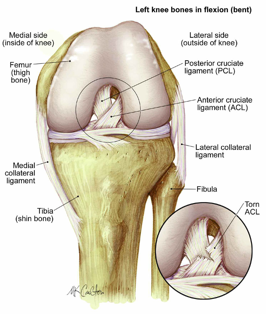 Anterior Cruciate Ligament (ACL) Reconstruction: Importance of Early Stage Rehab