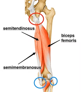 Diagram of the hamstring muscle group showing the semitendinosus, semimembranosus and biceps femoris and the proximal hamstring tendon at the sit bone