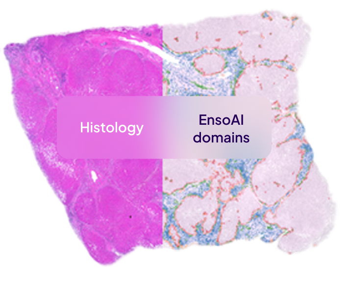 Tissue sample with pink histology stain on left and EnsoAI domain color segmentation on right.