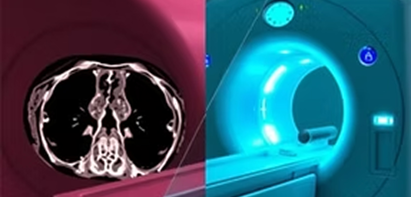 Why PET and CT answer different clinical questions — structural vs. metabolic imaging, side-by-side, with a cardiac PET deep dive.