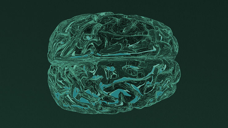 PET scan visualization of metabolic brain activity using a radioactive tracer