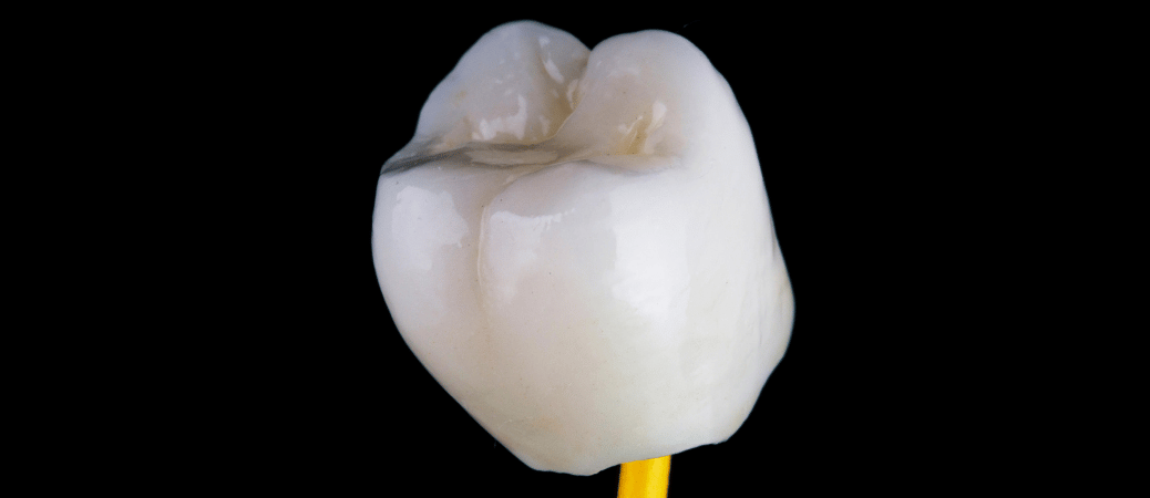 What to Do When a Dental Crown Falls Off: Night & Weekend Guide