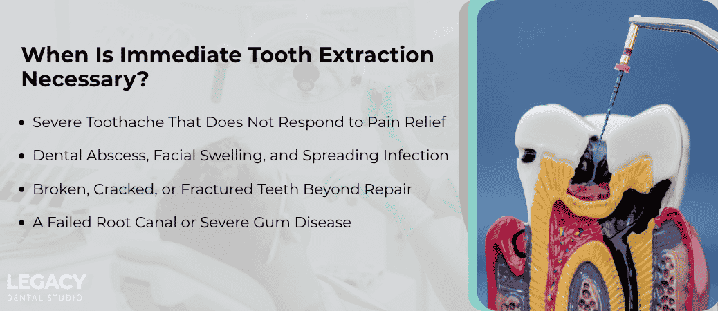 Who Needs an Extraction Without Delay?