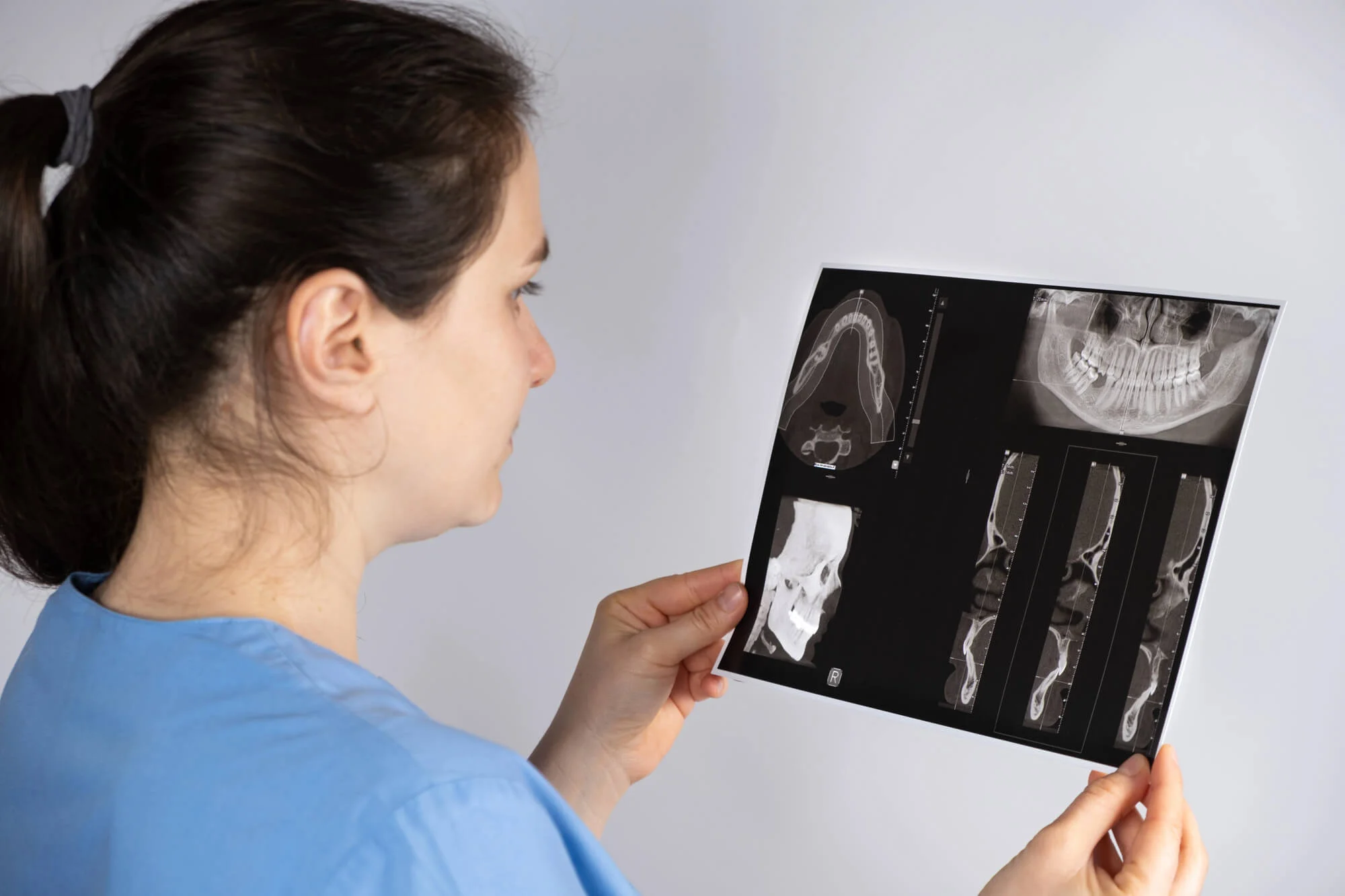 TMJ scan reviewed by a North Raleigh tmj dentist