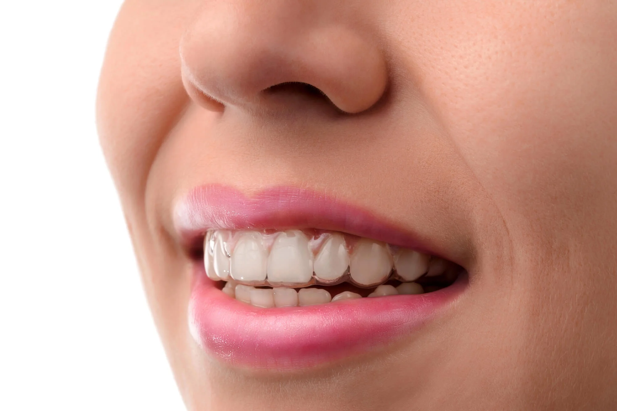 Smile wearing Invisalign in North Raleigh