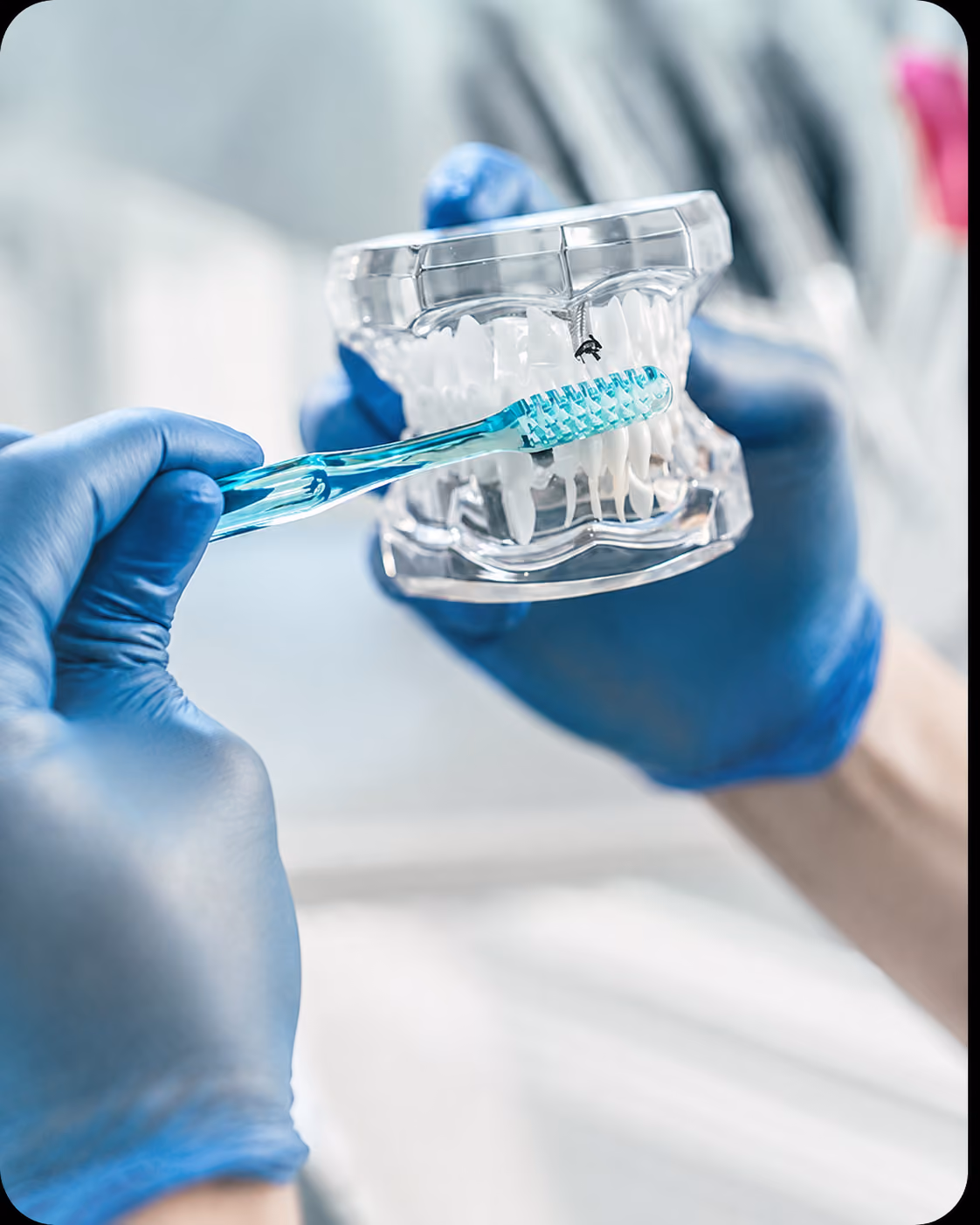 A gloved hand holds a toothbrush near a dental model with braces, demonstrating oral care.