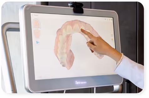 Hand pointing to a 3D digital model of teeth on a large screen in a dental setting.