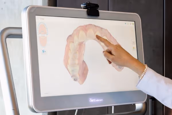 Hand pointing to a digital dental 3D model of teeth displayed on a screen.