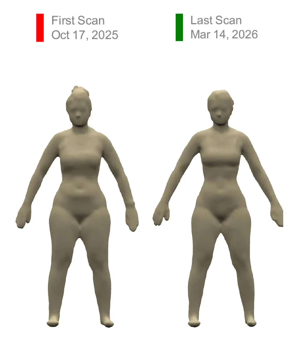 Ella A., before and after 3D scans