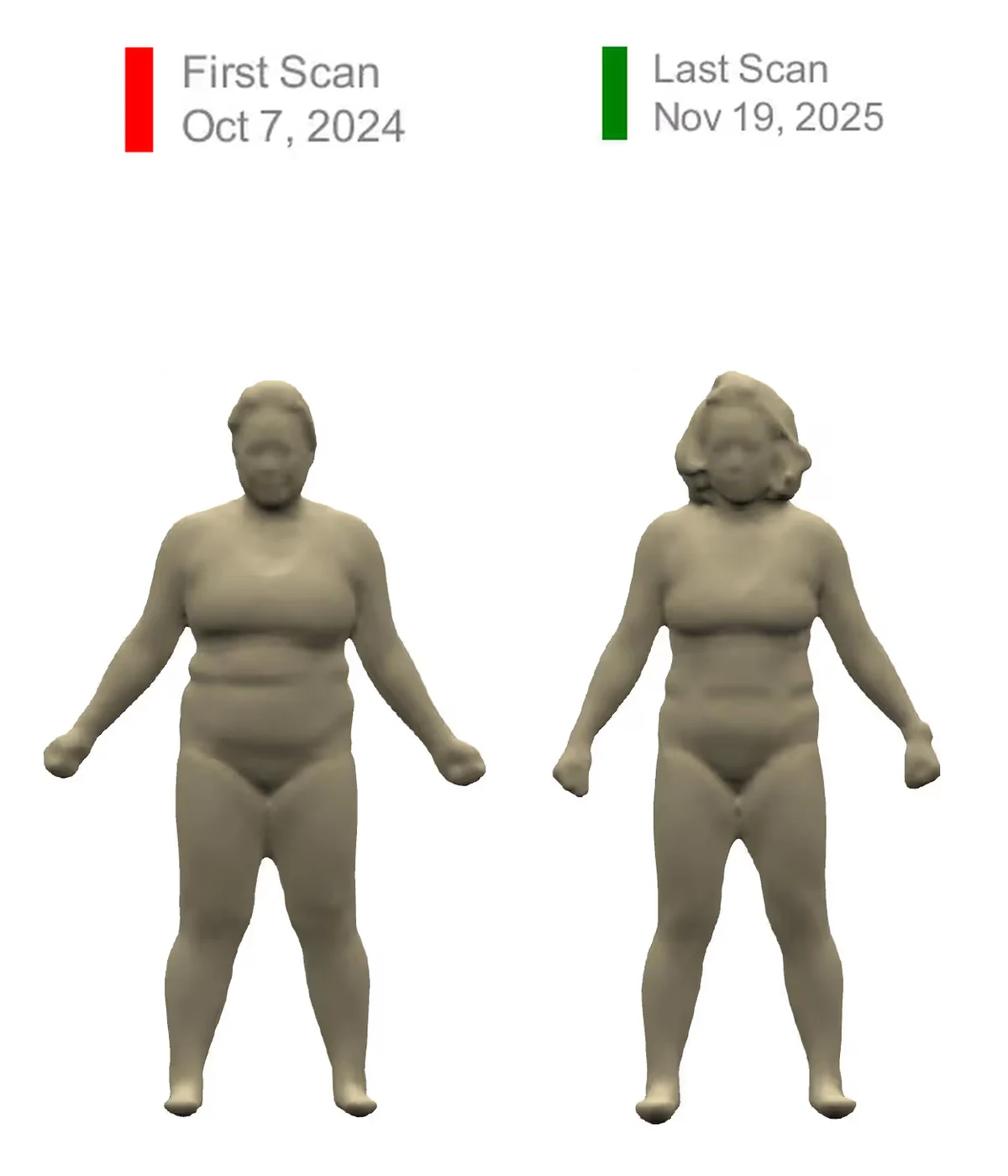 Marian M., before and after 3D scans
