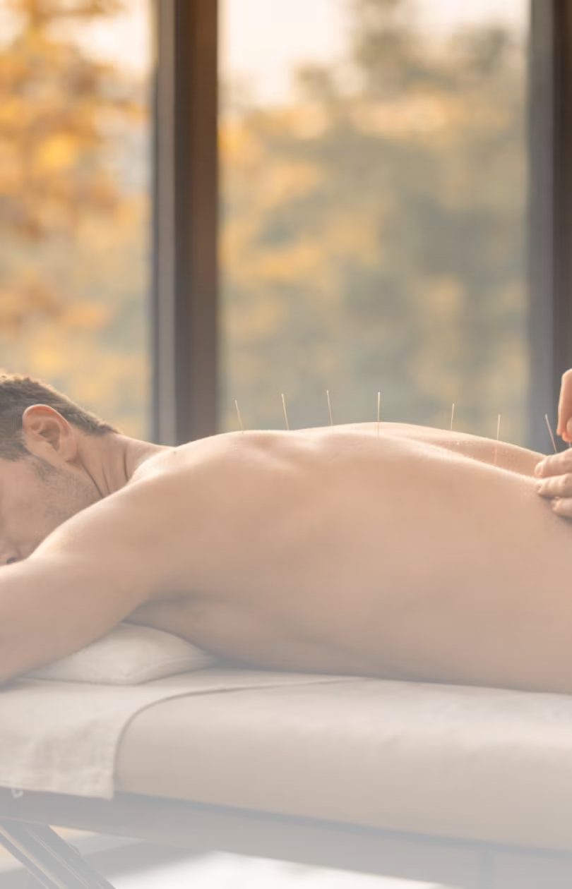 Man lying face down on a massage table receiving acupuncture treatment on his back.