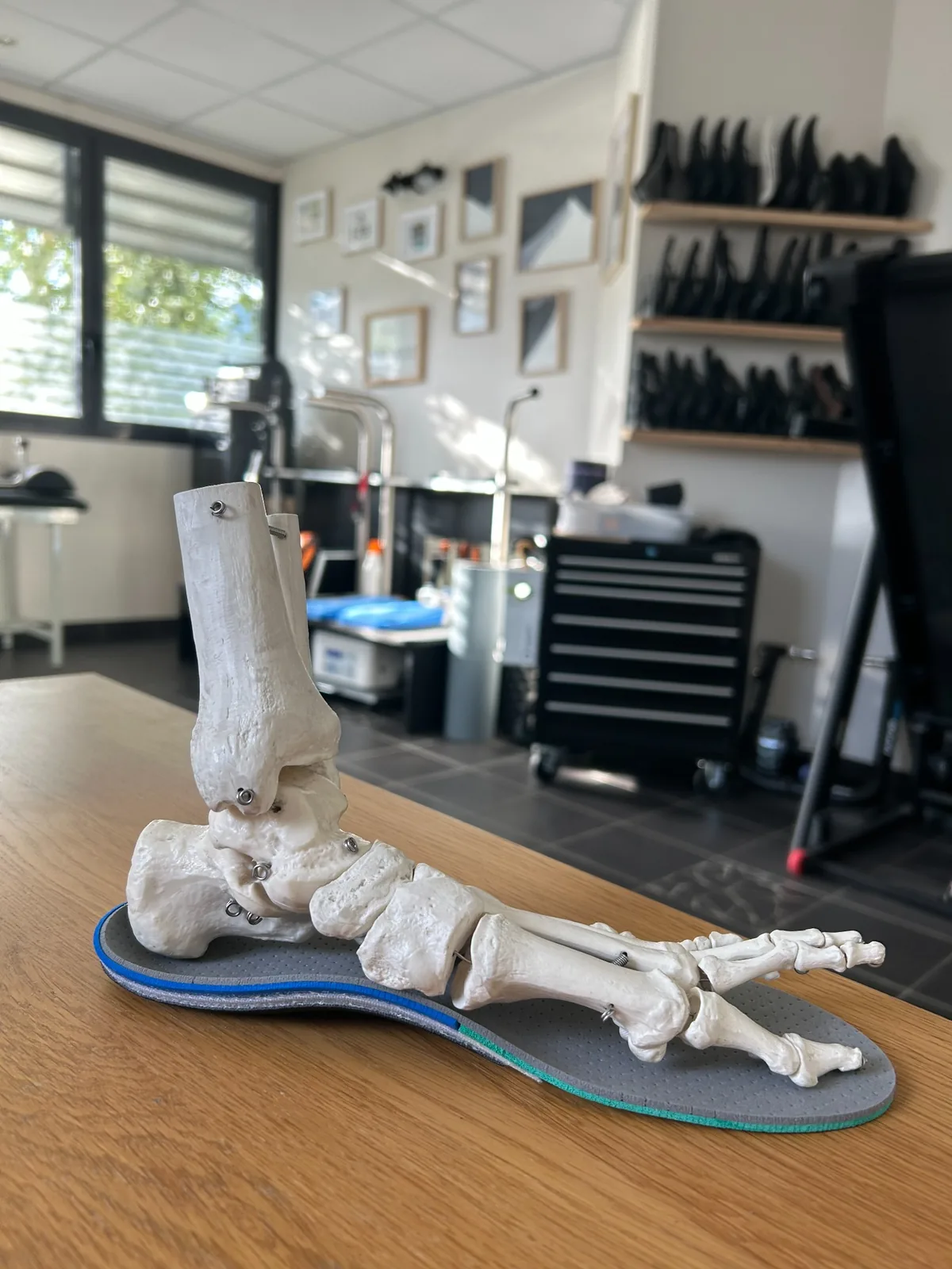 Modèle anatomique du pied et de la cheville posé sur une orthèse plantaire sur mesure au cabinet Belledonne Podologie près de Grenoble