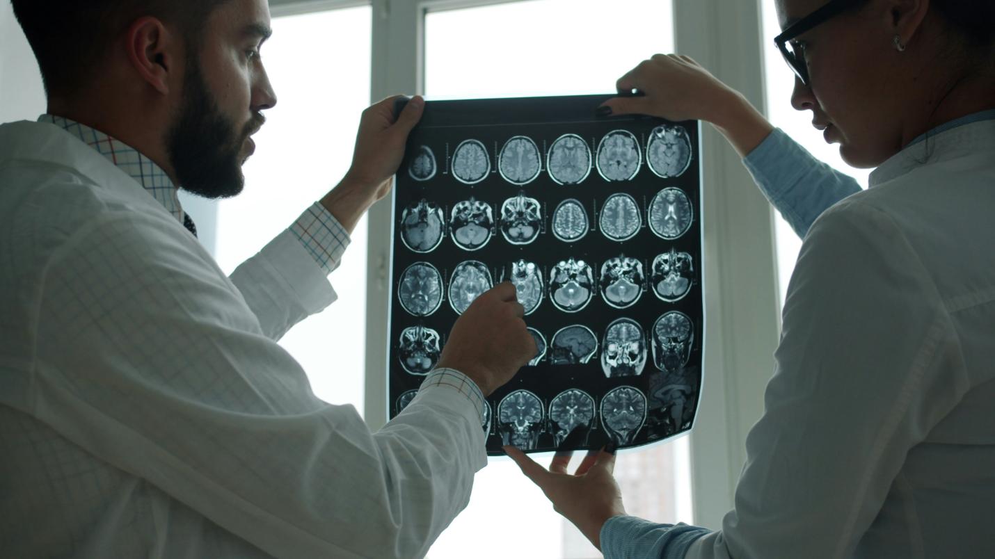 MRI brain scan on a medical display