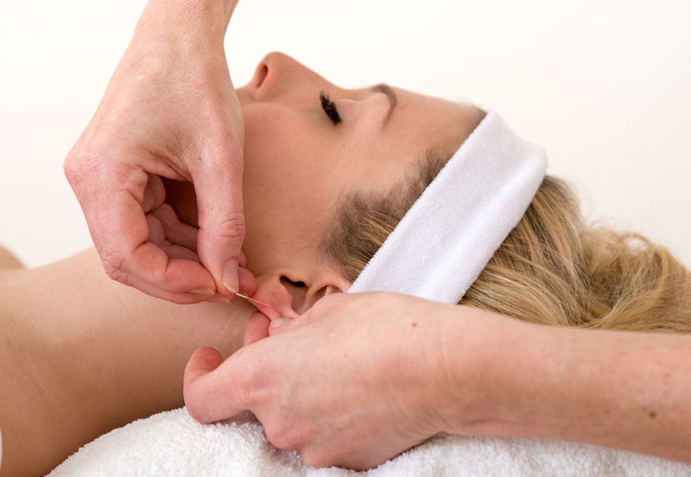 What’s an acupuncturist like you doing in a place like this?!!