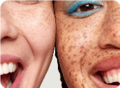 Banner strip