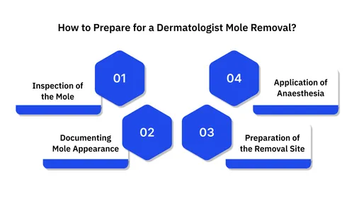 How to Prepare for a Dermatologist Mole Removal