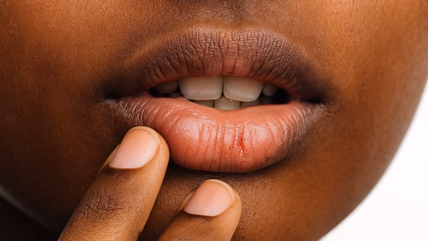 Medical Causes: When Lip Colour Signals a Health Issue